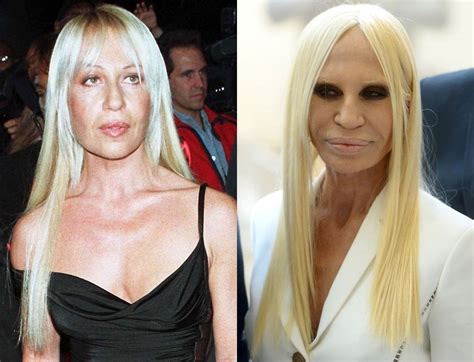 donatella versace collant|donatella versace before and after surgery.